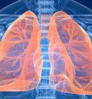 Πνευμονική υπέρταση: Η πρόγνωση, τα συμπτώματα και η αντιμετώπιση της