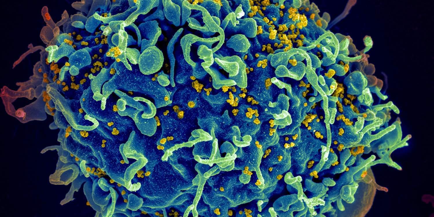 HIV: 500.000 νεκροί επιπλέον στη Νότια Αφρική σε διάστημα 10 ετών χωρίς τα αμερικανικά κονδύλια