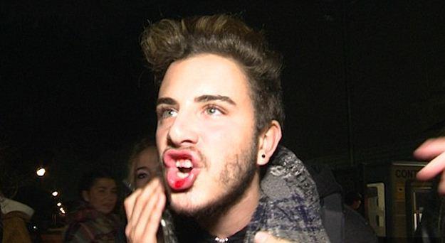 o-biber-xtupaei-fan-tou-me-mpounia-sto-prosopo-1300-1-%ce%b1%ce%bd%cf%84%ce%af%ce%b3%cf%81%ce%b1%cf%86%ce%bf