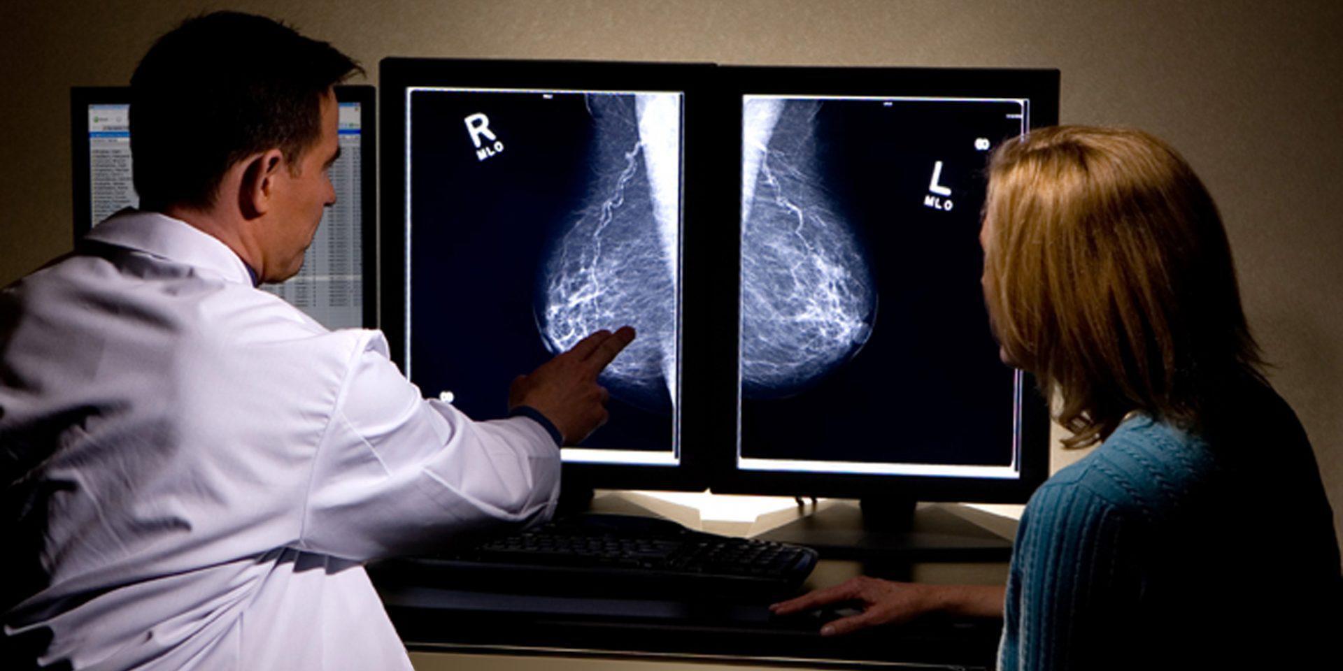 μαστού Καρκίνος του μαστού