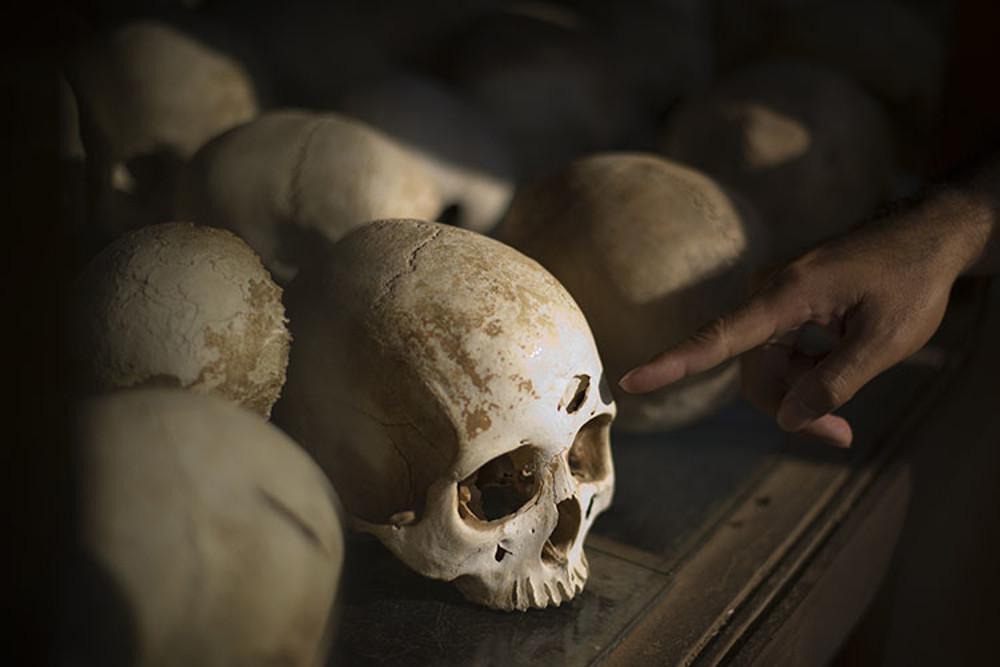 Χαλκίδα κρανίο