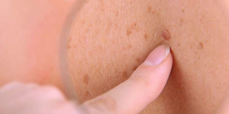 δερματολογικό