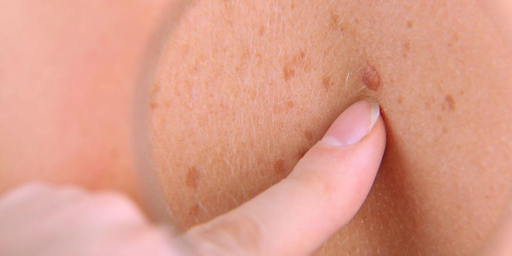 δερματολογικό