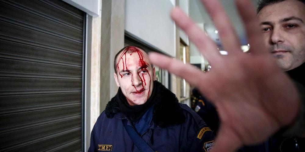 Χάος, βία, αίματα και επεισόδια στο Κέντρο μεταξύ ΠΑΜΕ και ΜΑΤ [εικόνες & βίντεο]