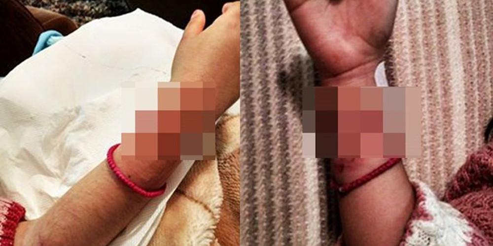 Σκύλος επιτέθηκε σε 7χρονο κορίτσι σε Χριστουγεννιάτικο χωριό στην Λέσβο