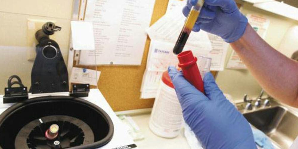 Ένας νεκρός στην Κίνα από τον ιό «hantavirus»