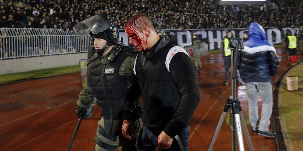 Χαροπαλεύει οπαδός στο Βελιγράδι – Πρωτοφανή επεισόδια στο Παρτιζάν – Ερυθρός Αστέρας [εικόνες & βίντεο]