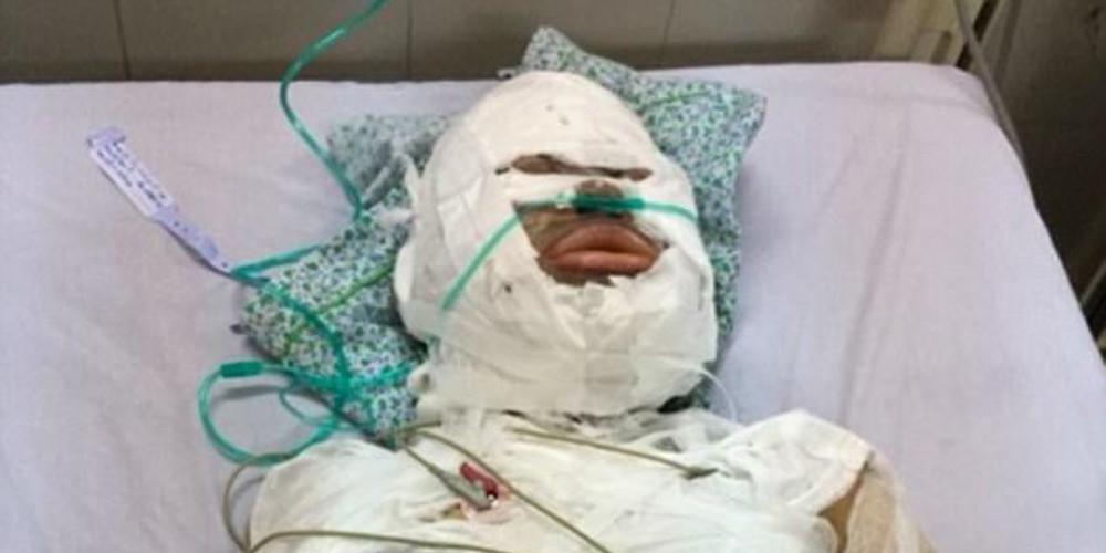 Φρίκη: Την πυρπόλησε γιατί του ζήτησε διαζύγιο [εικόνες]