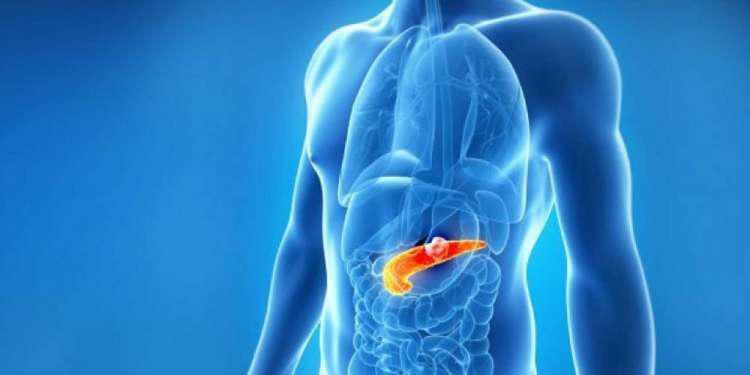 H σωστή απόφαση μπορεί να βελτιώσει την επιβίωση στον καρκίνο του παγκρέατος