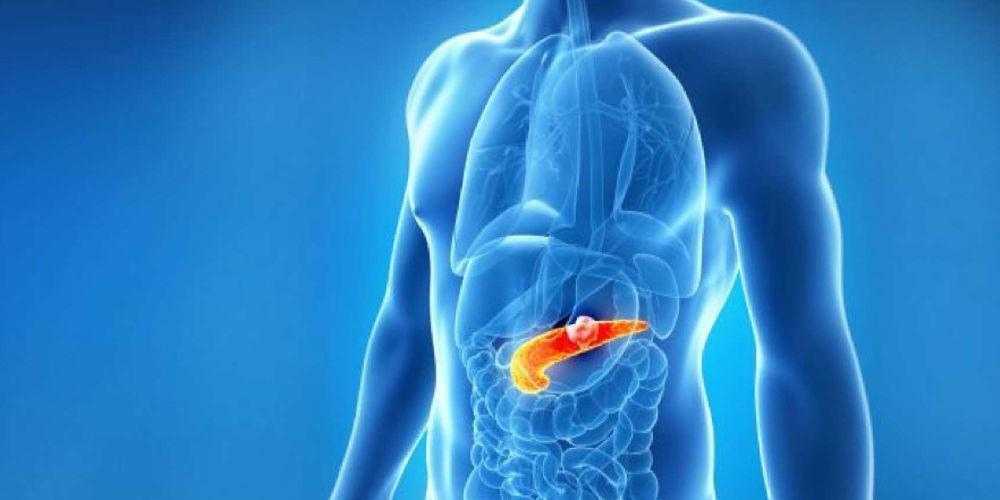 H σωστή απόφαση μπορεί να βελτιώσει την επιβίωση στον καρκίνο του παγκρέατος