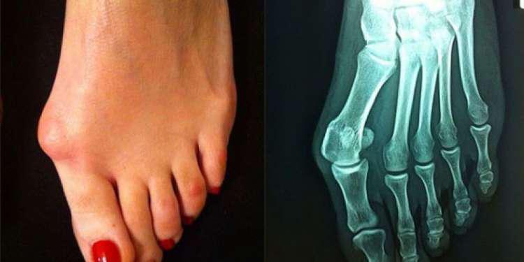 Πείτε αντίο στο κότσι