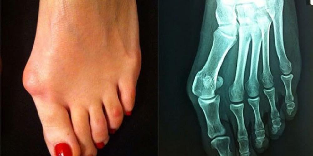 Πείτε αντίο στο κότσι