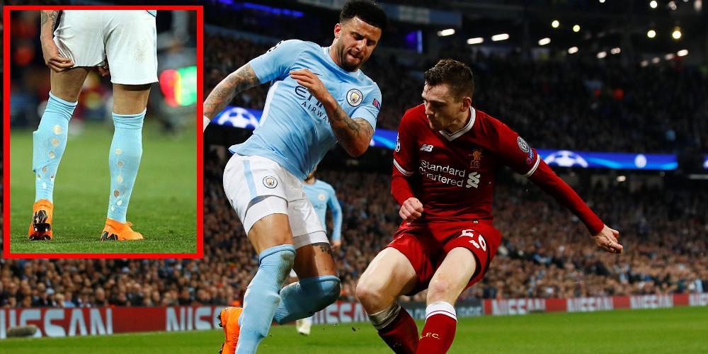Γιατί ο Γουόκερ τρύπησε τις κάλτσες του στο ματς Σίτι-Λίβερπουλ;
