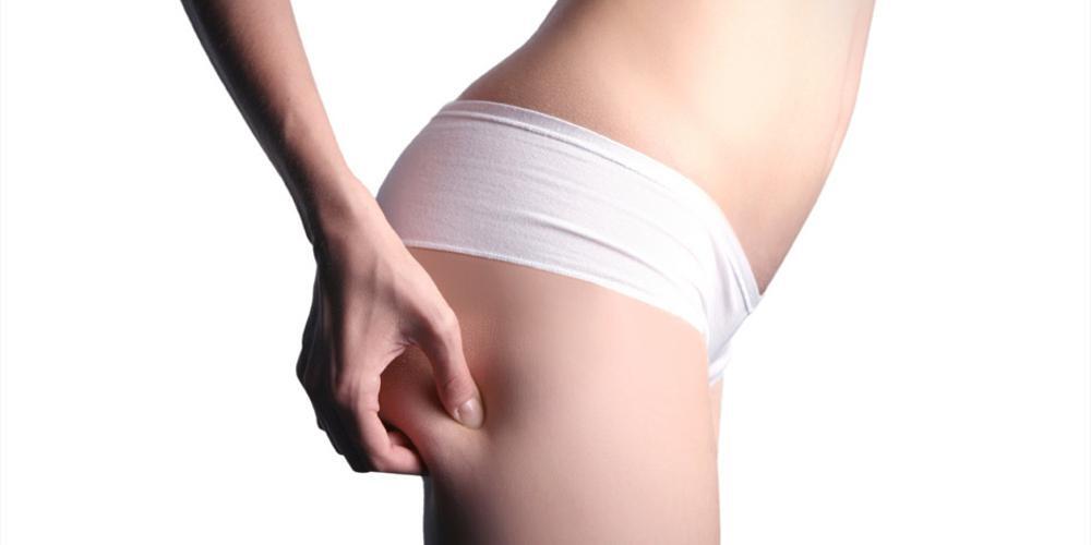 Lipolaser: Μείωση τοπικού λίπους και κυτταρίτιδας χωρίς χαλάρωση