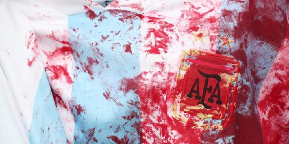 Ισραήλ- Αργεντινή: Ένα φιλικό γεμάτο… αίμα