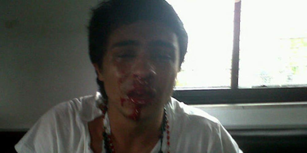 Πολιτικός κρατούμενος από τη Βενεζουέλα στον Ελεύθερο Τύπο: Με έχουν χτυπήσει στο σώμα και την ψυχή, μου έχουν στερήσει τα πάντα