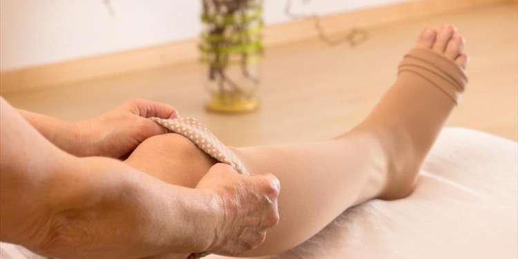 Κιρσοί στους άντρες: Σύγχρονες και ανώδυνες λύσεις