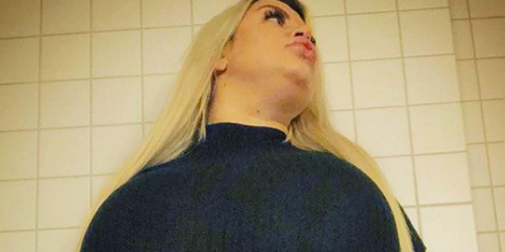 Θέλει να αποκτήσει τα μεγαλύτερα οπίσθια του κόσμου αλλά κινδυνεύει να πεθάνει! [εικόνες]