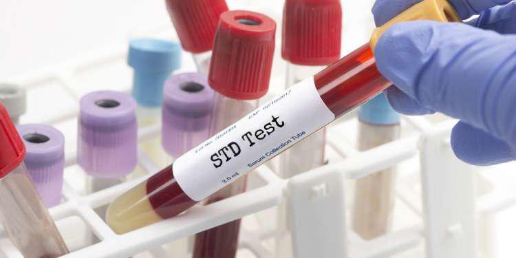 Τέσσερα νέα Σεξουαλικώς Μεταδιδόμενα Νοσήματα που πρέπει να προσέξεις