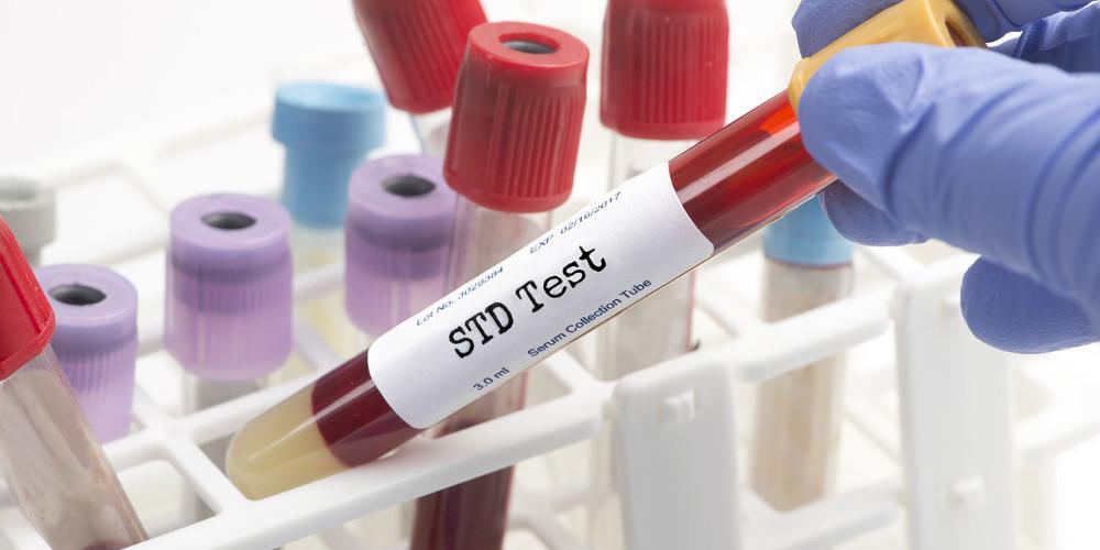 Τέσσερα νέα Σεξουαλικώς Μεταδιδόμενα Νοσήματα που πρέπει να προσέξεις
