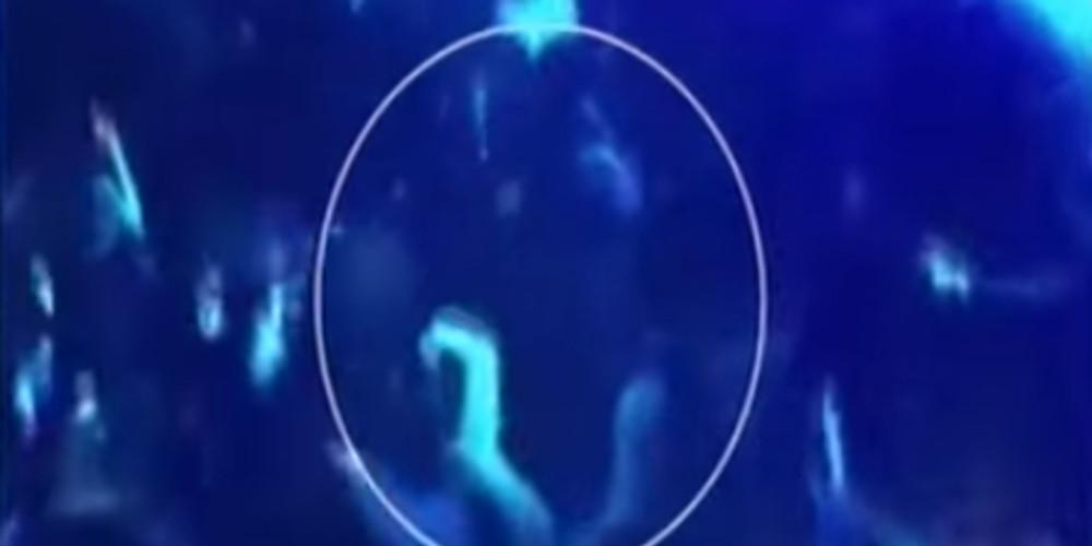 Έκανε 120 ράμματα ο νεαρός που χτυπήθηκε με μπουκάλι στον Σαμπάνη [βίντεο]