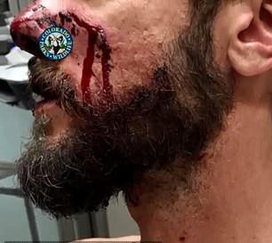 Δρομέας έπνιξε με τα χέρια πάνθηρα που του επιτέθηκε [εικόνες]