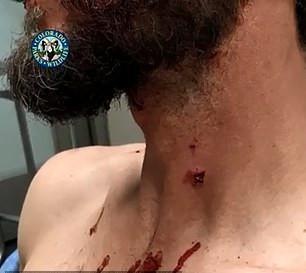 Δρομέας έπνιξε με τα χέρια πάνθηρα που του επιτέθηκε [εικόνες]