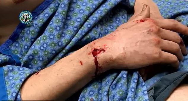 Δρομέας έπνιξε με τα χέρια πάνθηρα που του επιτέθηκε [εικόνες]