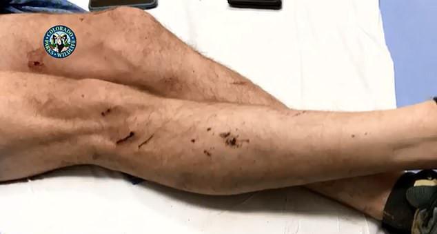 Δρομέας έπνιξε με τα χέρια πάνθηρα που του επιτέθηκε [εικόνες]