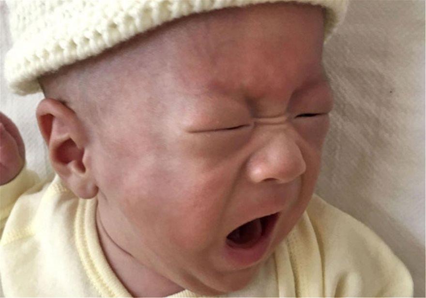 Απίστευτο: Το μικρότερο μωρό στον κόσμο από 268 γραμμάρια έφτασε τα 3,2 κιλά! [εικόνες]