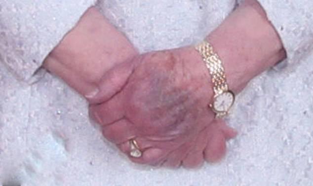 Ανησυχία για την Ελισάβετ μετά από φωτογραφίες με μεγάλη κηλίδα στο χέρι της [εικόνες]