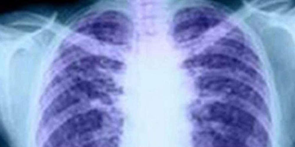 Επιστήμονες στη Γερμανία δημιούργησαν διαφανή ανθρώπινα όργανα