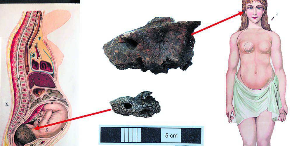 Αρχαιολογική ανακάλυψη μιας ανθρώπινης τραγωδίας… 28 αιώνων!