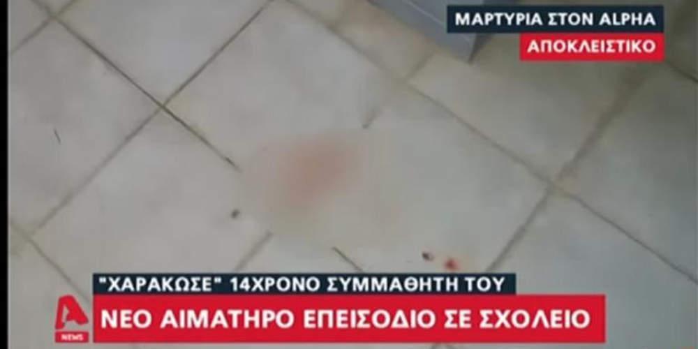 Νέο επεισόδιο σε σχολείο: 14χρονος χαράκωσε συμμαθητή του στο πρόσωπο