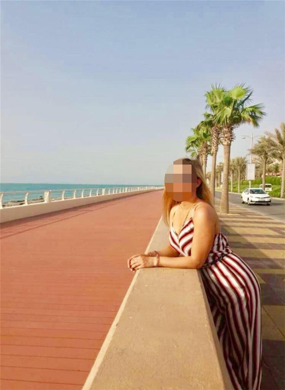 Επίθεση με βιτριόλι στην Καλλιθέα: Τι είπε η γιατρός που χειρούργησε την 34χρονη και που οδηγούν οι έρευνες