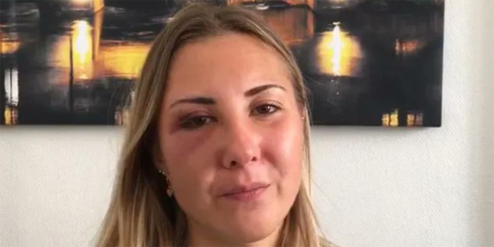 Σοκαριστικό περιστατικό στο Στρασβούργο: Επιτέθηκαν με μπουνιές σε φοιτήτρια επειδή φορούσε φούστα
