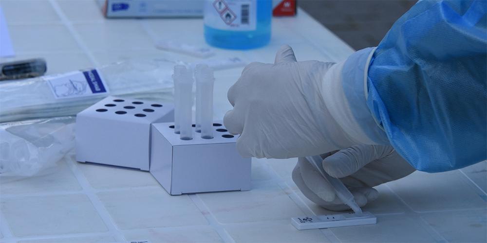 ΕΟΔΥ: Πού και ποιες ώρες θα γίνονται δωρεάν rapid test τη Δευτέρα (22/11)