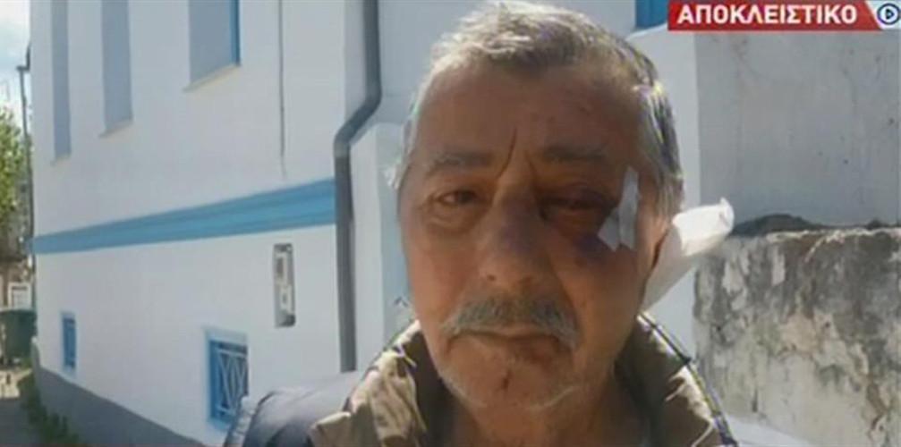 Κουκουλοφόροι ληστές βασάνισαν ζευγάρι στην Αχαΐα