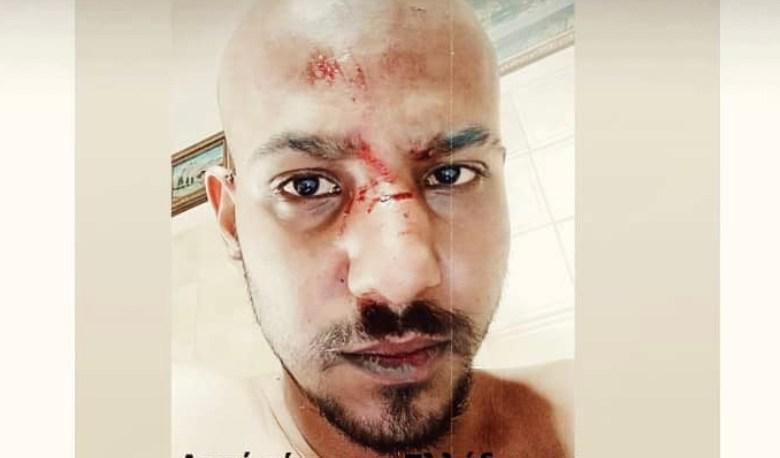 Ναύπακτος: Άγριο ξύλο σε νεαρό για την διαφορετικότητά του!