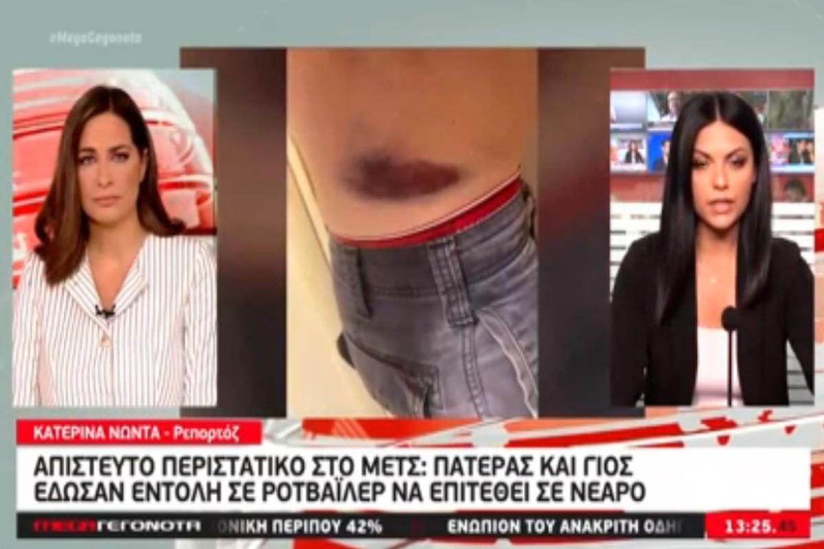 Μετς: Πατέρας και γιος έδωσαν εντολή στον σκύλο τους να επιτεθεί σε 30χρονο – Σοκάρει η καταγγελία