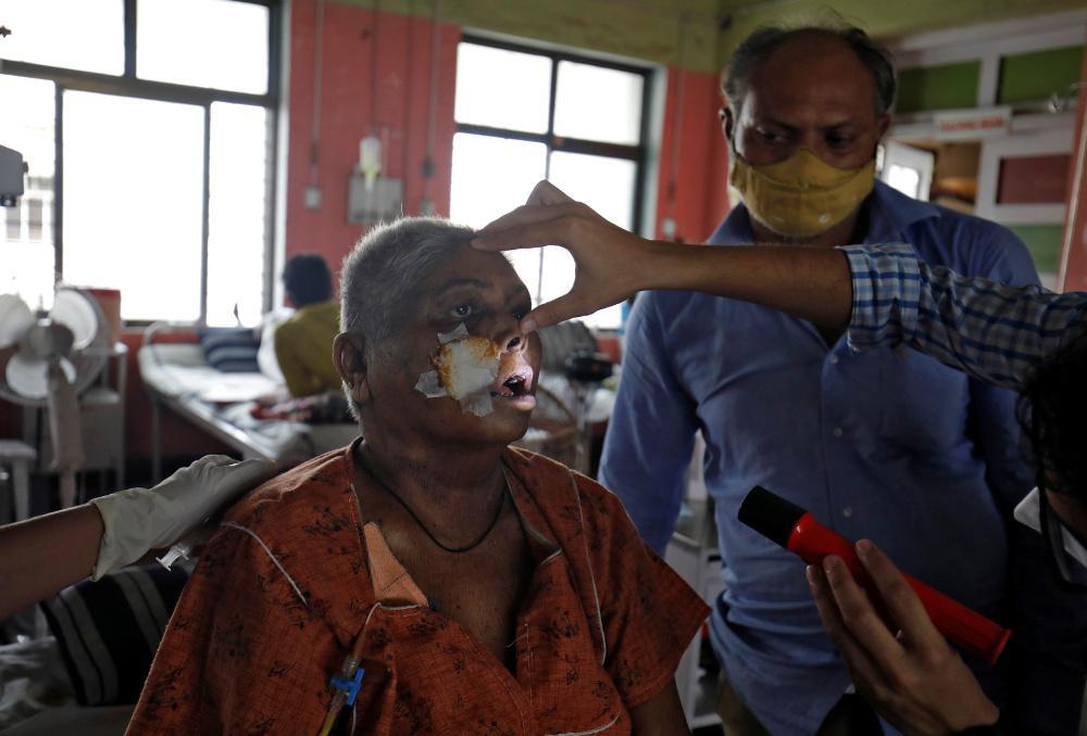 Μαύρος μύκητας