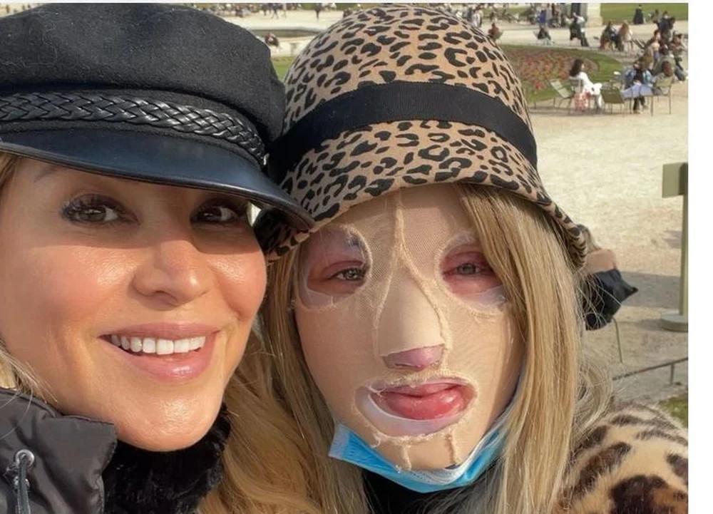 Ιωάννα Παλιοσπύρου: Η έκκληση της Αννίτας Ναθαναήλ - «Να μη σοκαριστεί ο κόσμος όταν βγάλει τη μάσκα»