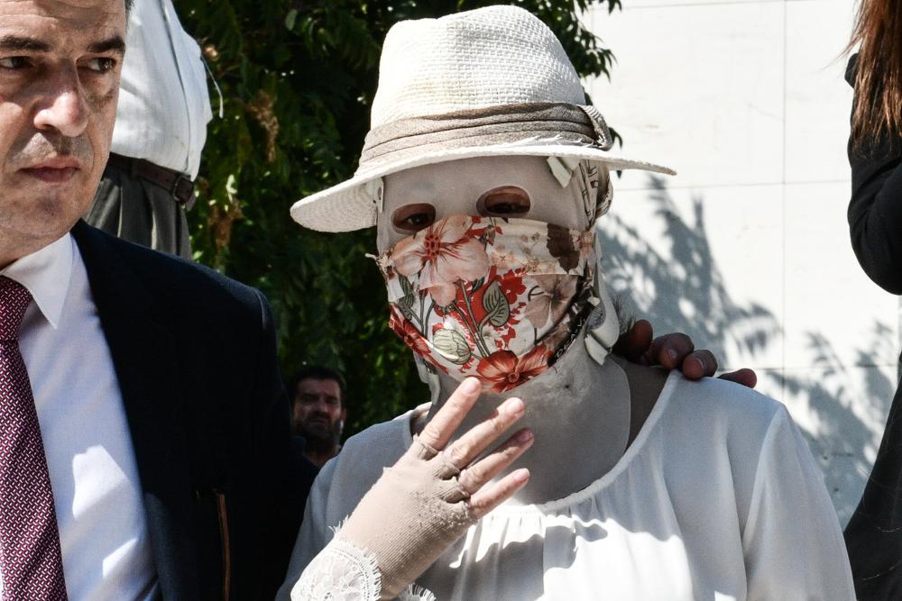 Επίθεση με βιτριόλι: Νέες αποκαλύψεις – Η δράστις ζητούσε την παρακολούθηση της Ιωάννας και του 40χρονου συνεργού της