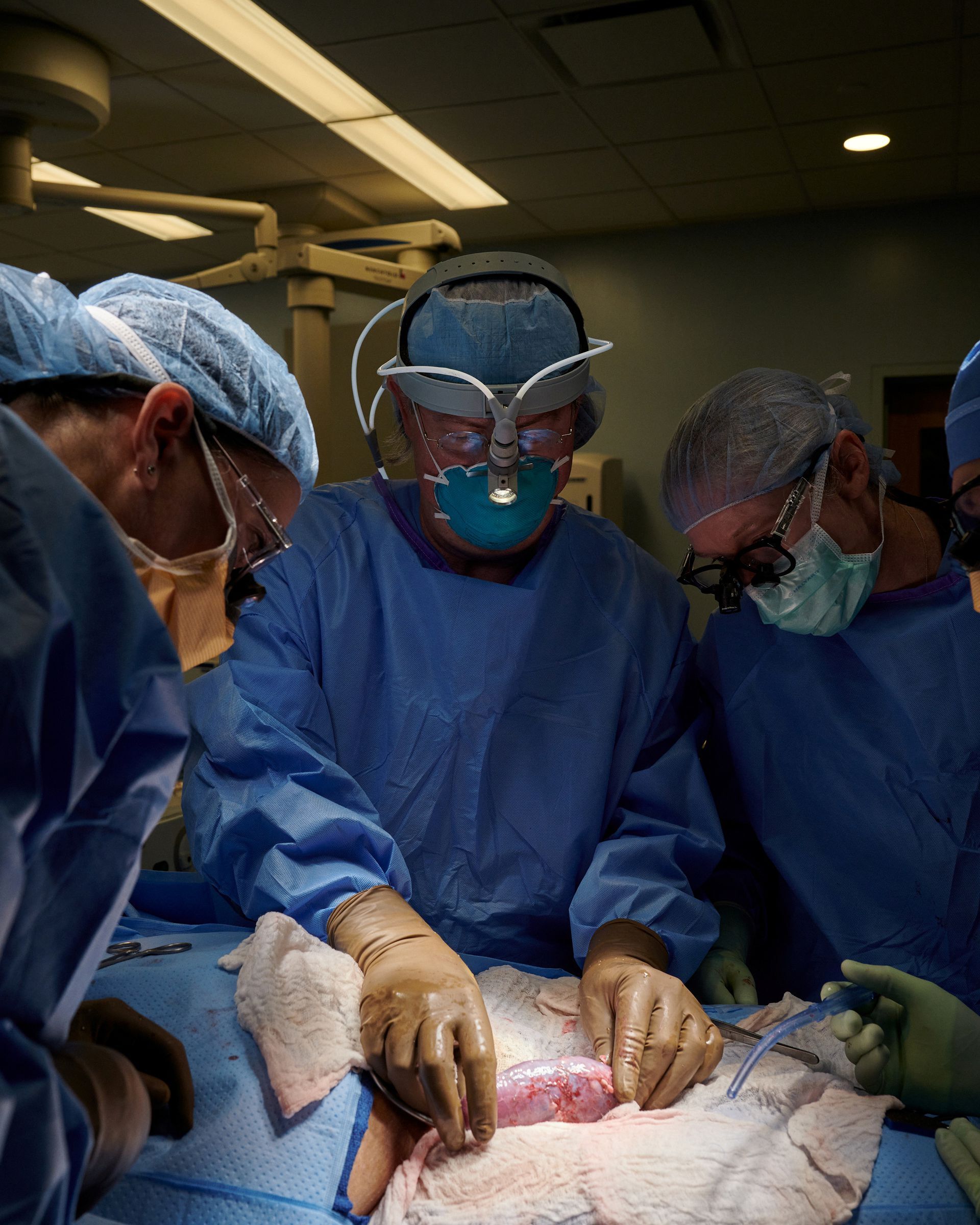 μεταμόσχευση