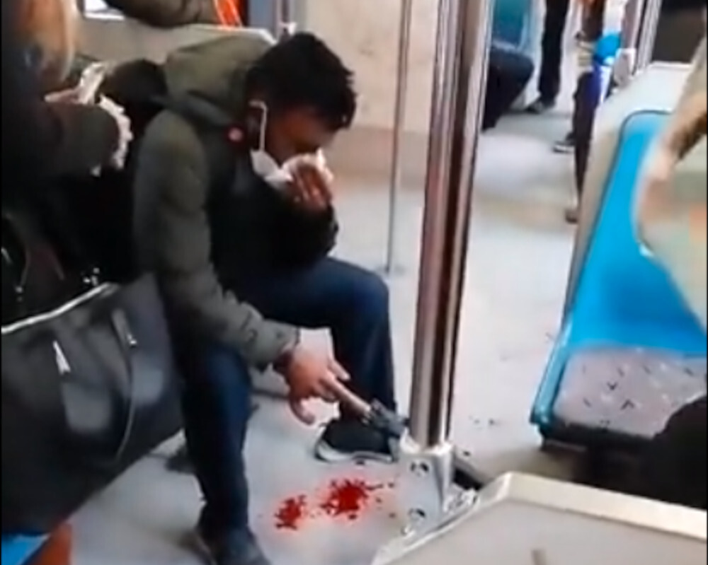 ΗΣΑΠ ρατσιστική επίθεση