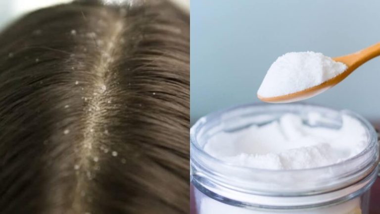 Tips: 6 λόγοι για να χρησιμοποιείτε μαγειρική σόδα στο δέρμα και στα μαλλιά