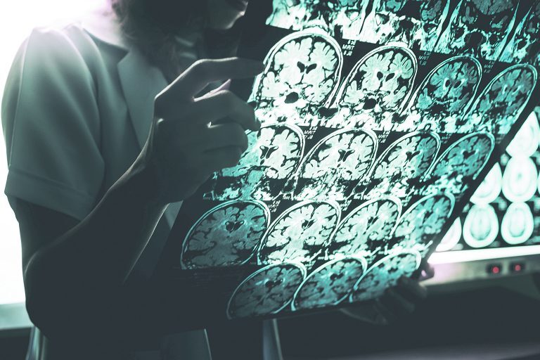 Όταν η καινοτομία συναντά την εμπειρία στη θεραπεία της πολλαπλής σκλήρυνσης