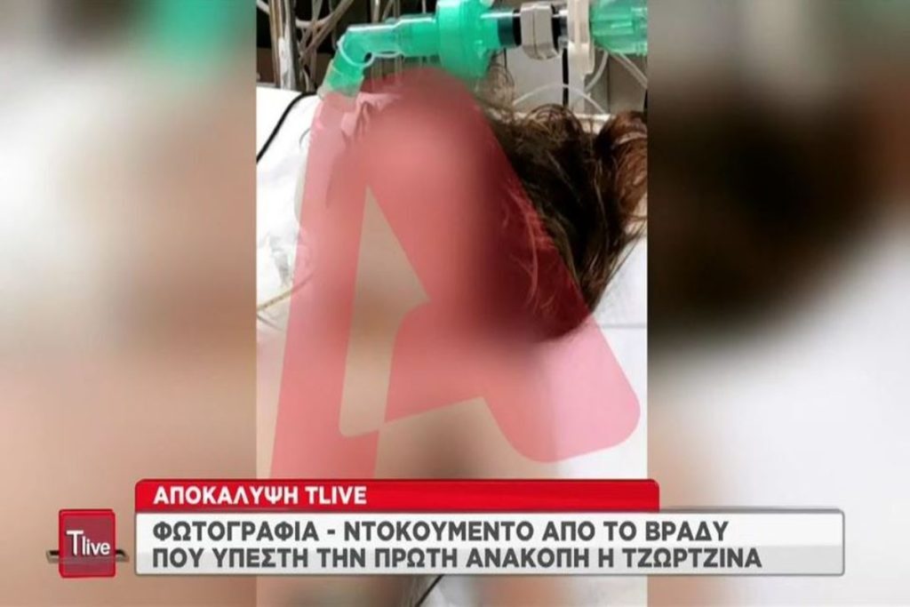 Πάτρα: Φωτογραφία – ντοκουμέντο από το βράδυ που η Τζωρτζίνα υπέστη ανακοπή [βίντεο]