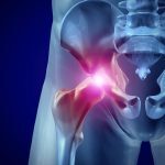 Αρθροπλαστική γόνατος και ισχίου: τα «ρομπότ»…έδιωξαν τον πόνο
