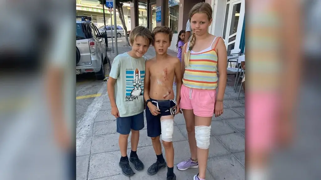 Τρόμος για οικογένεια Βρετανών από αγέλη σκύλων: «Πιστέψαμε ότι θα πεθάνουμε», λέει ο πατέρας